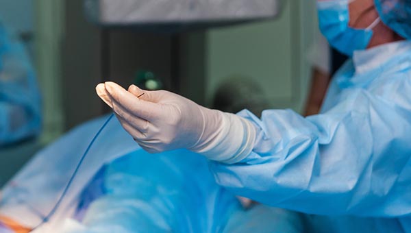 peripheral angioplasty